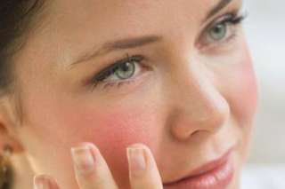 أفضل الطرق لعلاج احمرار الوجه