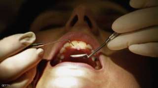 علماء يطورون مادة يمكن أن تساعد في تجديد مينا الأسنان