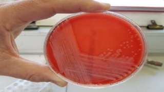 علماء يكتشفون نوع غير معروف من البكتيريا