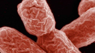 طريقة القضاء على البكتيريا ”الخارقة”.. بفيروسات ”تأكلها”