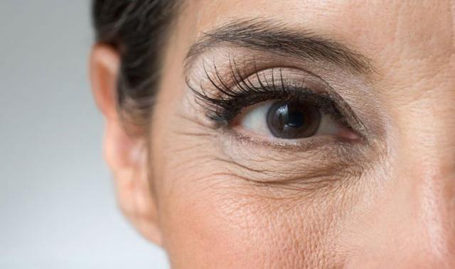 أسباب وعلاج ترهل الجلد حول العين | المرأة والصحة | الصباح العربي