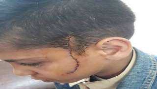 ضبط الطالب المتهم بـتمزيق وجه زميله بمدرسة بالمرج