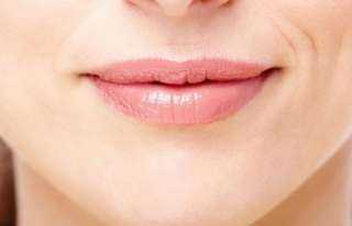 خلطة طبيعية للتخلص من البقع الغامقة حول الفم