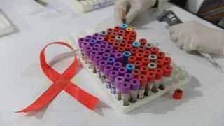 جهاز قابل للزرع ”يمنع الإصابة بفيروس نقص المناعة لمدة عام”
