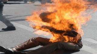 بـ”ولاعة”.. مسن يشعل النار فى جسده لإصابته بالوسواس القهري بكفر الشيخ