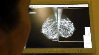 بذرة مغناطيسية تنهي الحاجة إلى جراحة ثانية لسرطان الثدي