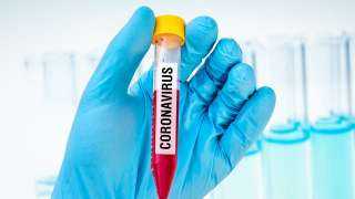 دراسة: دواء استخدم ضد ”إيبولا” يثبت فاعليته ضد كورونا