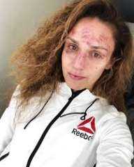 شيفتشينكو الكبرى تكشف عن وجهها بعد تلقيها 45 ضربة 