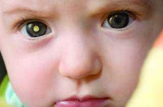 علامات تشير لمعاناة طفلك من مشكلة في بصره
