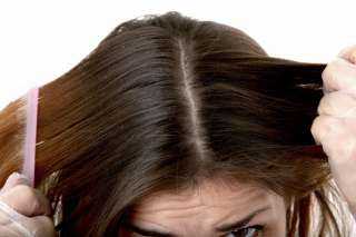 طرق طبيعية للتخلص من قشرة الشعر