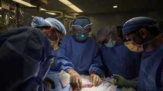 نيويورك تايمز: أطباء أمريكيون ينجحون فى زرع كلية خنزير بجسم إنسان