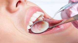 مجموعة أمراض ترتبط بصحة تجويف الفم
