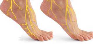 علاج التهاب الأعصاب في الأرجل
