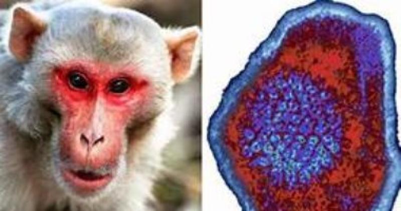 الصحة تكشف أعراض الإصابة بجدرى القرود 