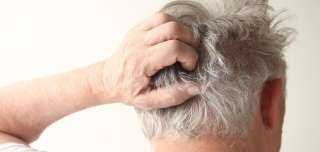 5 مشكلات صحية قد تسبب آلام فروة الرأس