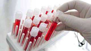 اختبار للدم يكشف 50 نوعاً من السرطان