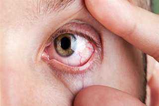 أعراض سرطان العين