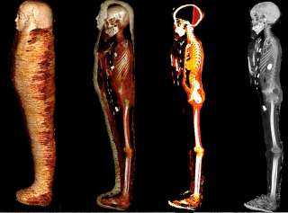 وزارة السياحة والآثار: الأشعة المقطعية تكشف أسرار مومياء الصبي الذهبي ببدروم المتحف المصري بالتحرير