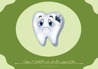 علاج تآكل الأسنان عند الأطفال
