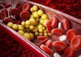 عادات يومية خاطئة تزيد الدهون الثلاثية بالدم