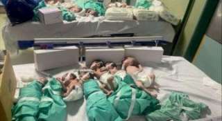 استشهاد 15 طفلا نتيجة سوء التغذية والجفاف في مستشفى كمال عدوان بغزة