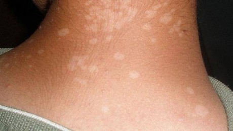 المخمل لحاف صخرة ما معنى الفطريات الجلدية Guillotinpoilvet Com